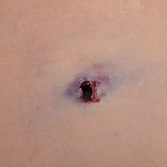 TOMManikin Gunshot Wound Chest Skin
